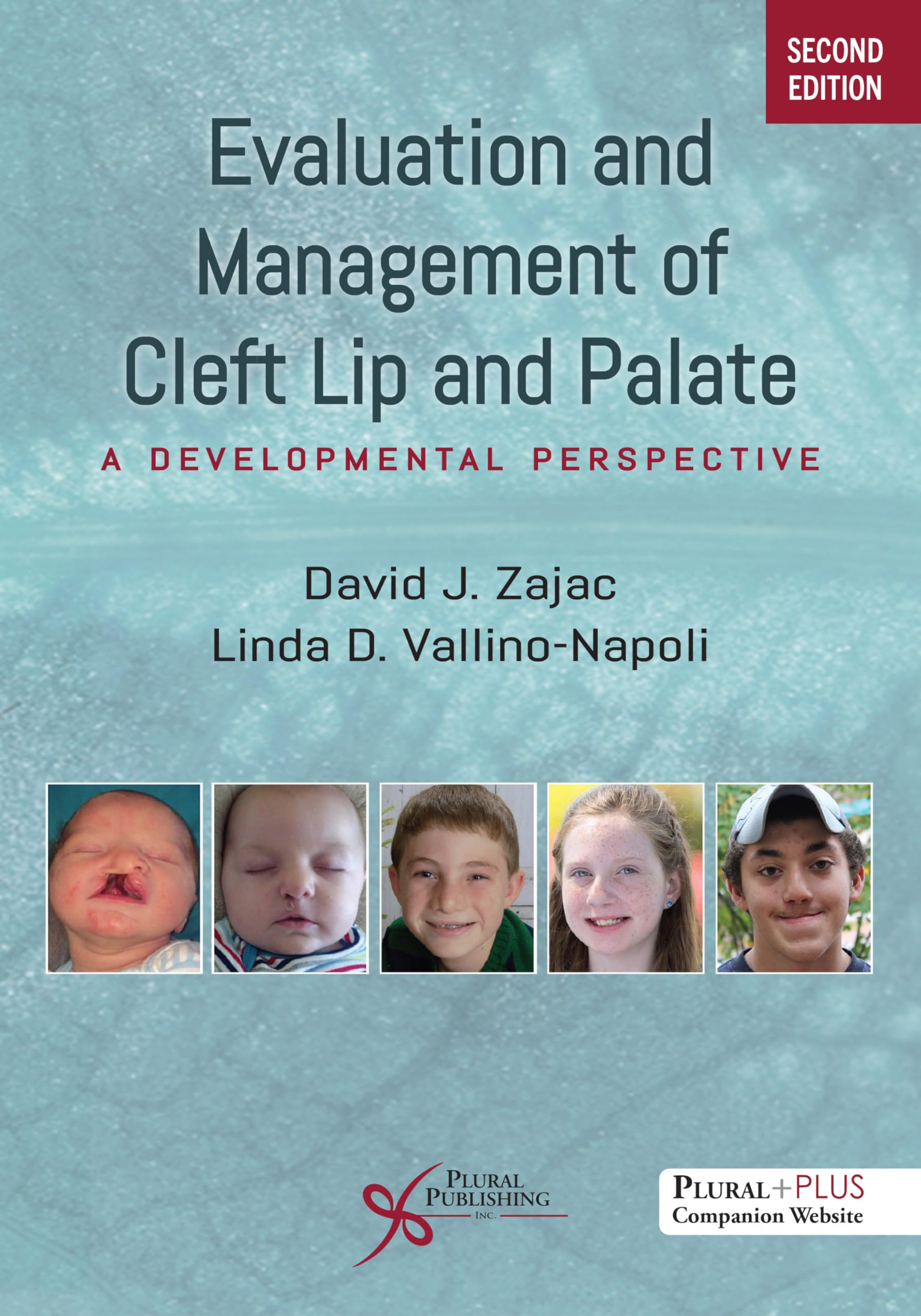 Cover of Evaluation and Management of Cleft Lip and Palate: A Developmental Perspective, Second Edition