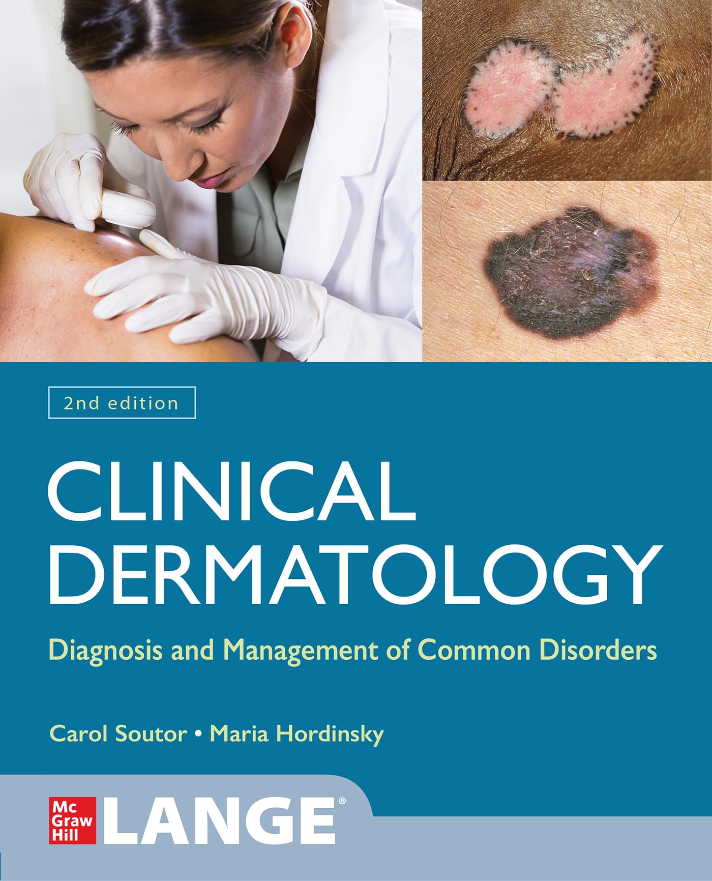 Cover of Clinical Dermatology: Diagnosis and Management of Common Disorders, Second Edition