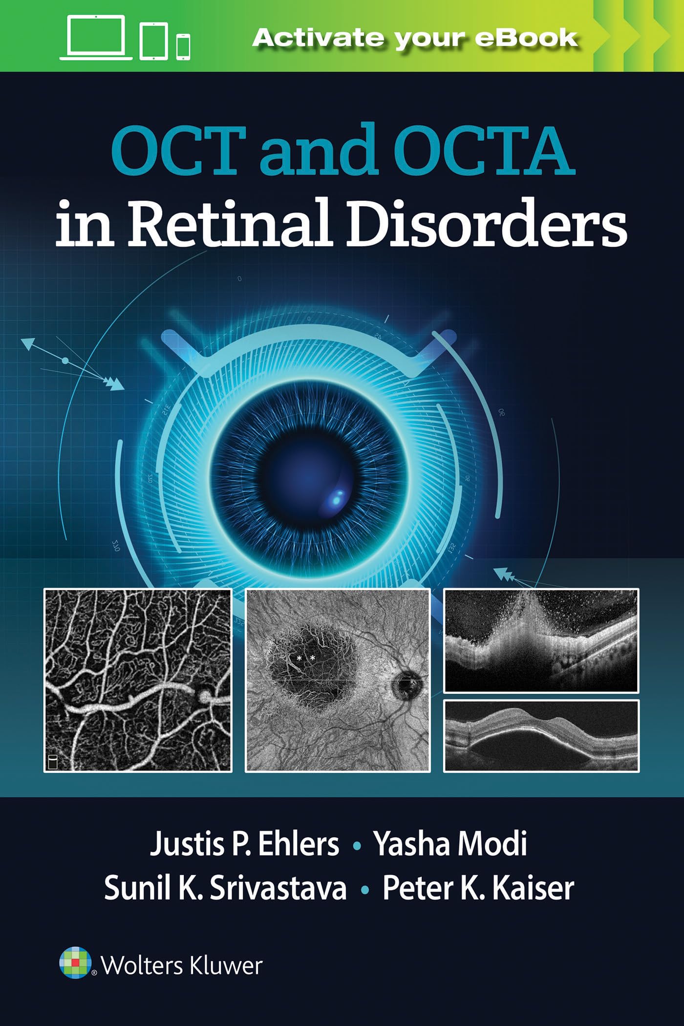 Cover of Oct and Octa in Retinal Disorders