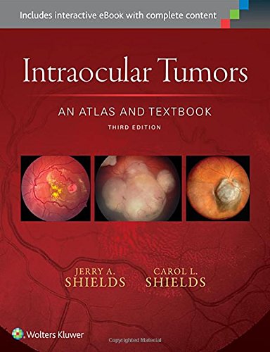 Cover of Intraocular Tumors: An Atlas and Textbook
