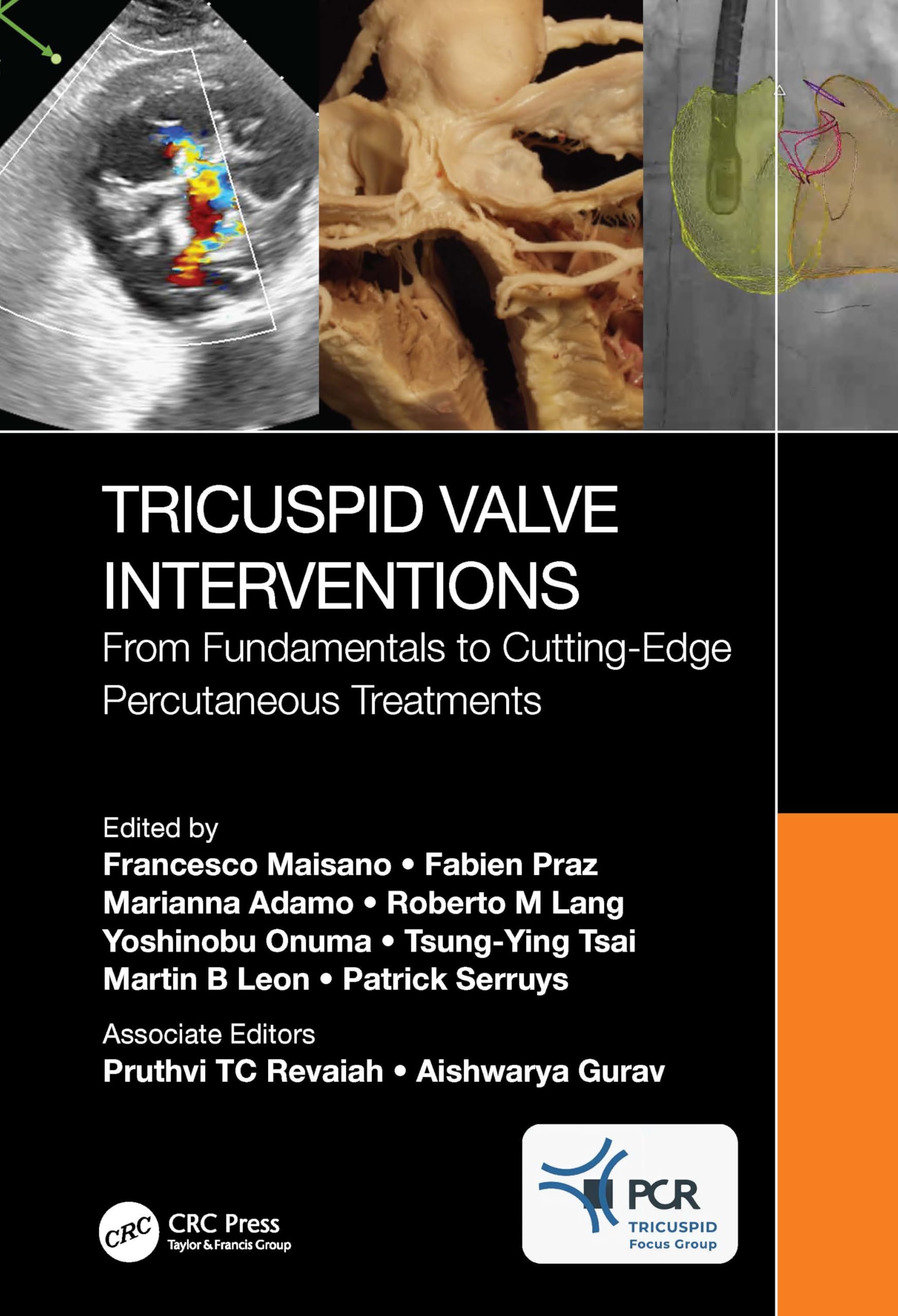 Cover of Tricuspid Valve Interventions: From Fundamentals to Cutting-Edge Percutaneous Treatments