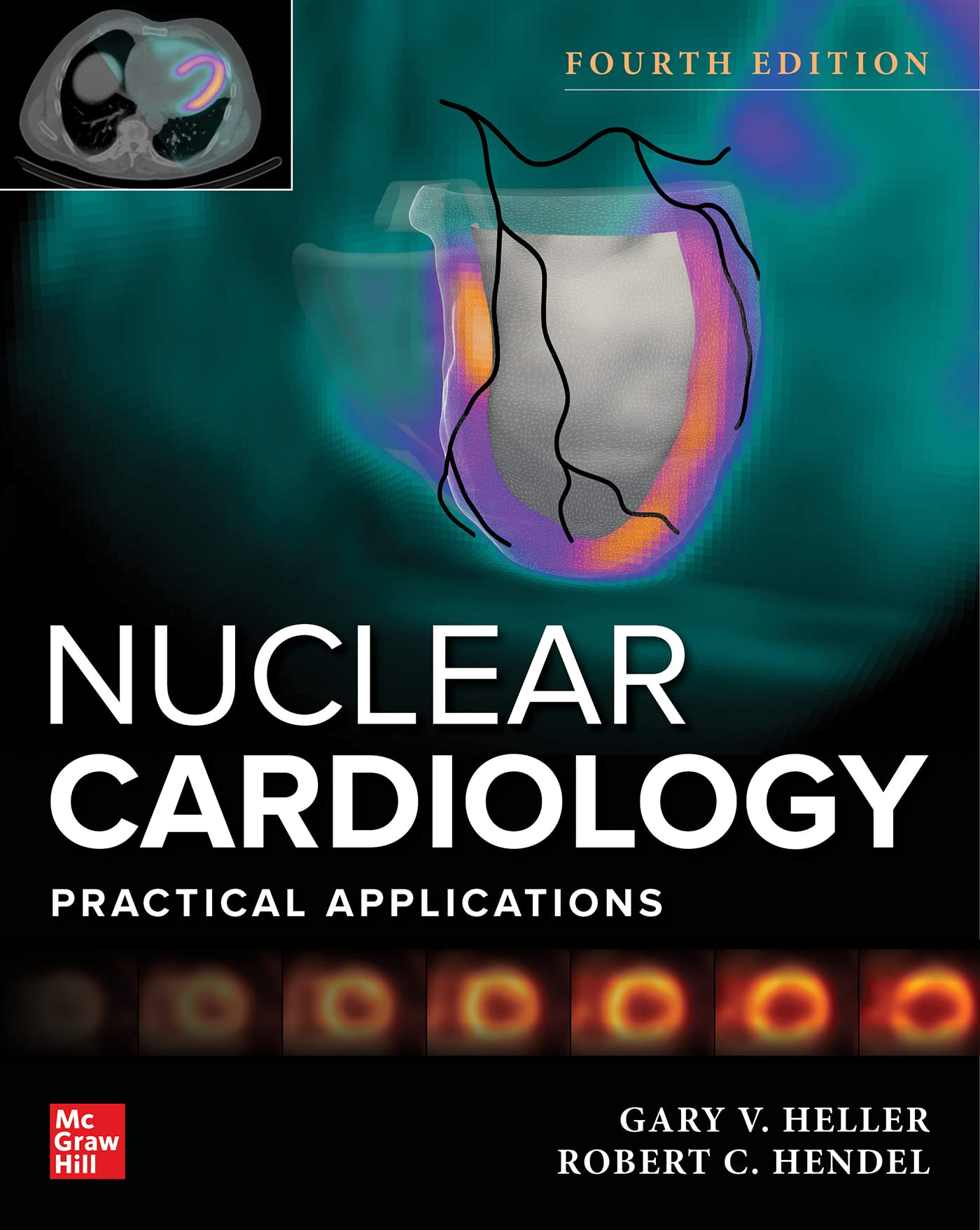 Cover of Nuclear Cardiology: Practical Applications, Fourth Edition
