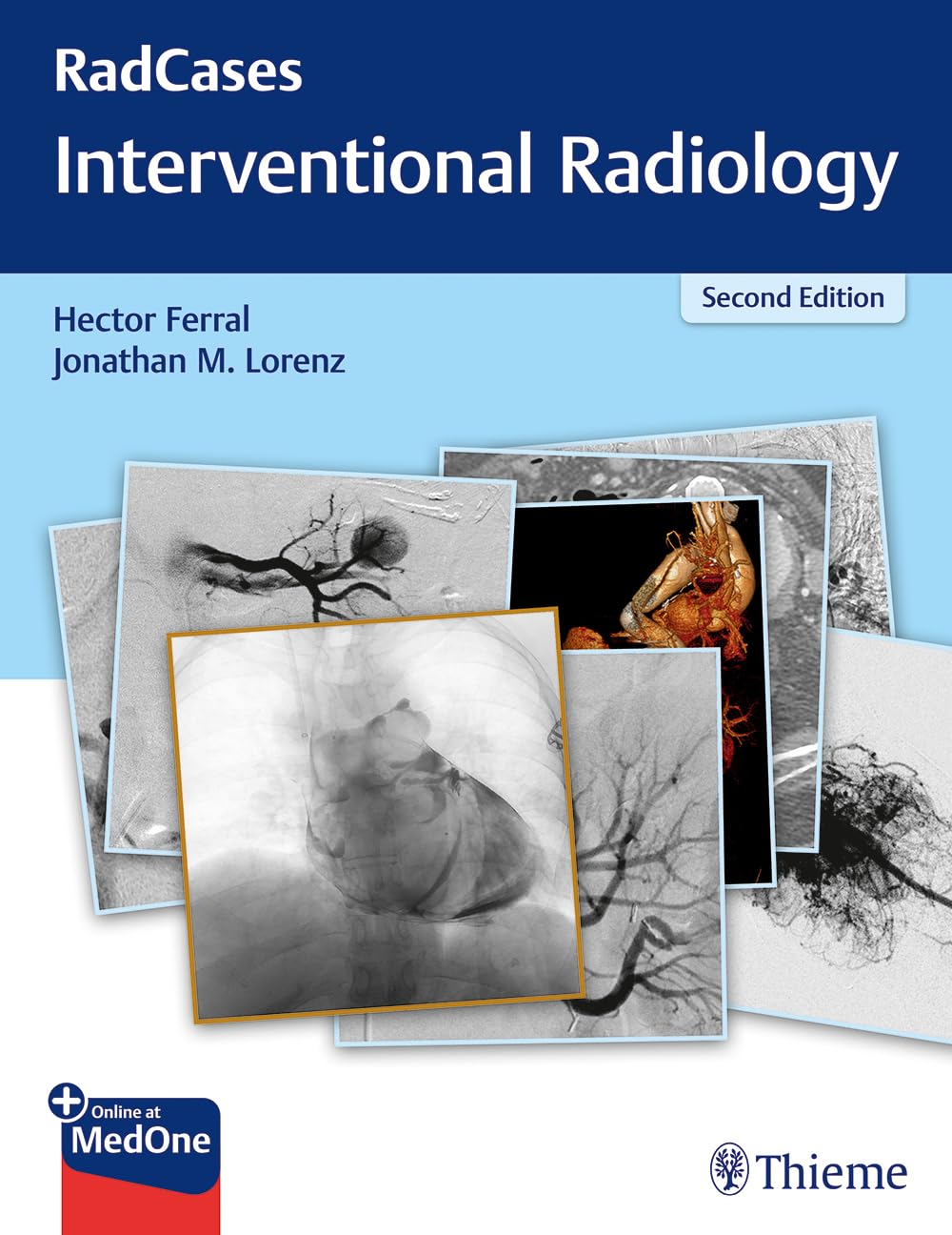 Cover of Radcases Q&A Interventional Radiology