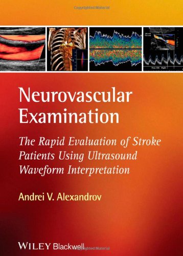 Cover of Neurovascular Examination: The Rapid Evaluation of Stroke Patients Using Ultrasound Waveform Interpretation