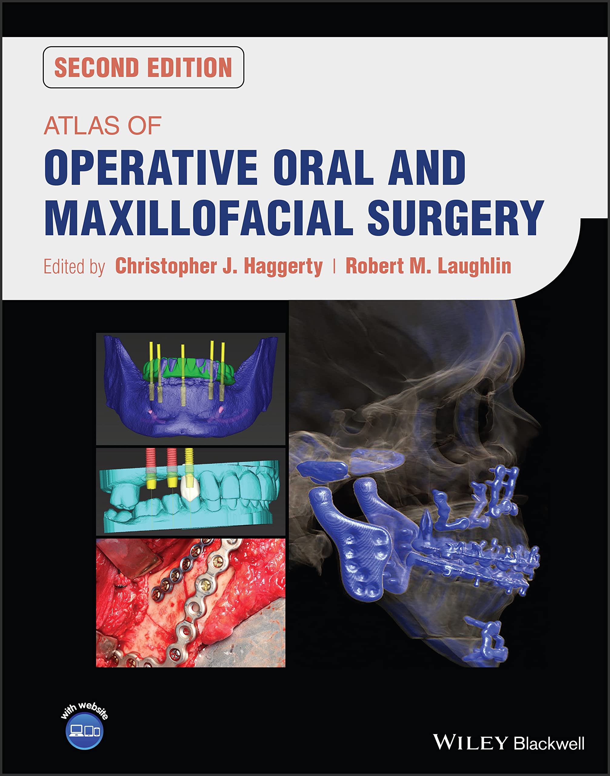 Cover of Atlas of Operative Oral and Maxillofacial Surgery