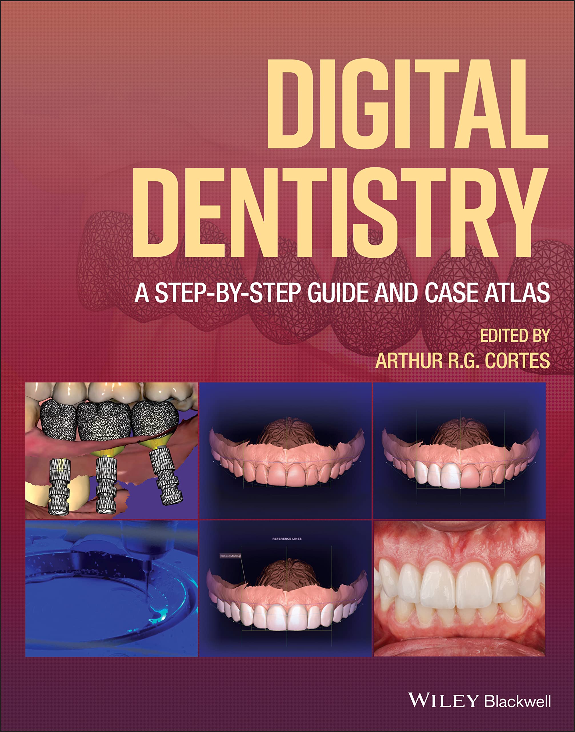 Cover of Digital Dentistry: A Step-by-Step Guide and Case Atlas