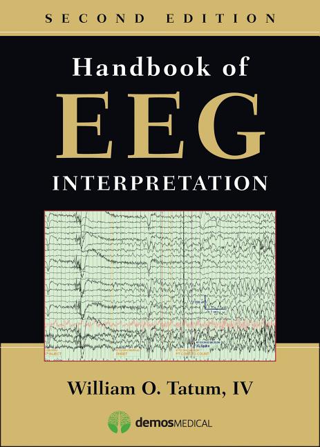 Cover of Handbook of Eeg Interpretation
