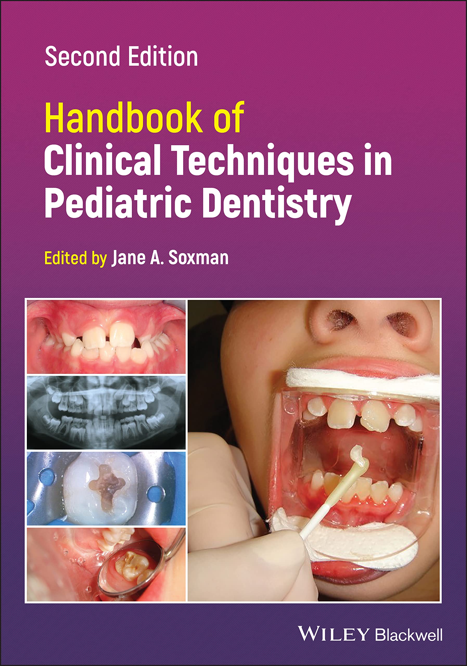 Cover of Handbook of Clinical Techniques in Pediatric Dentistry