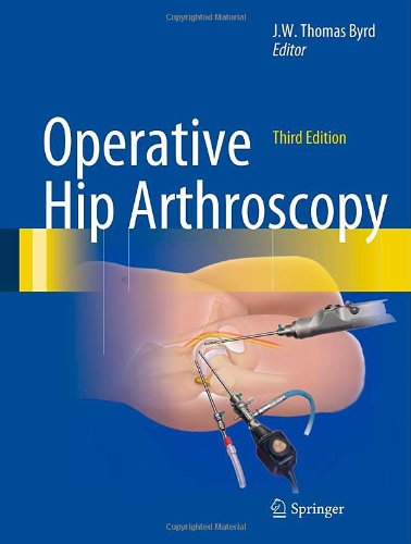 Cover of Operative Hip Arthroscopy (Byrd, Operative Hip Arthroscopy)