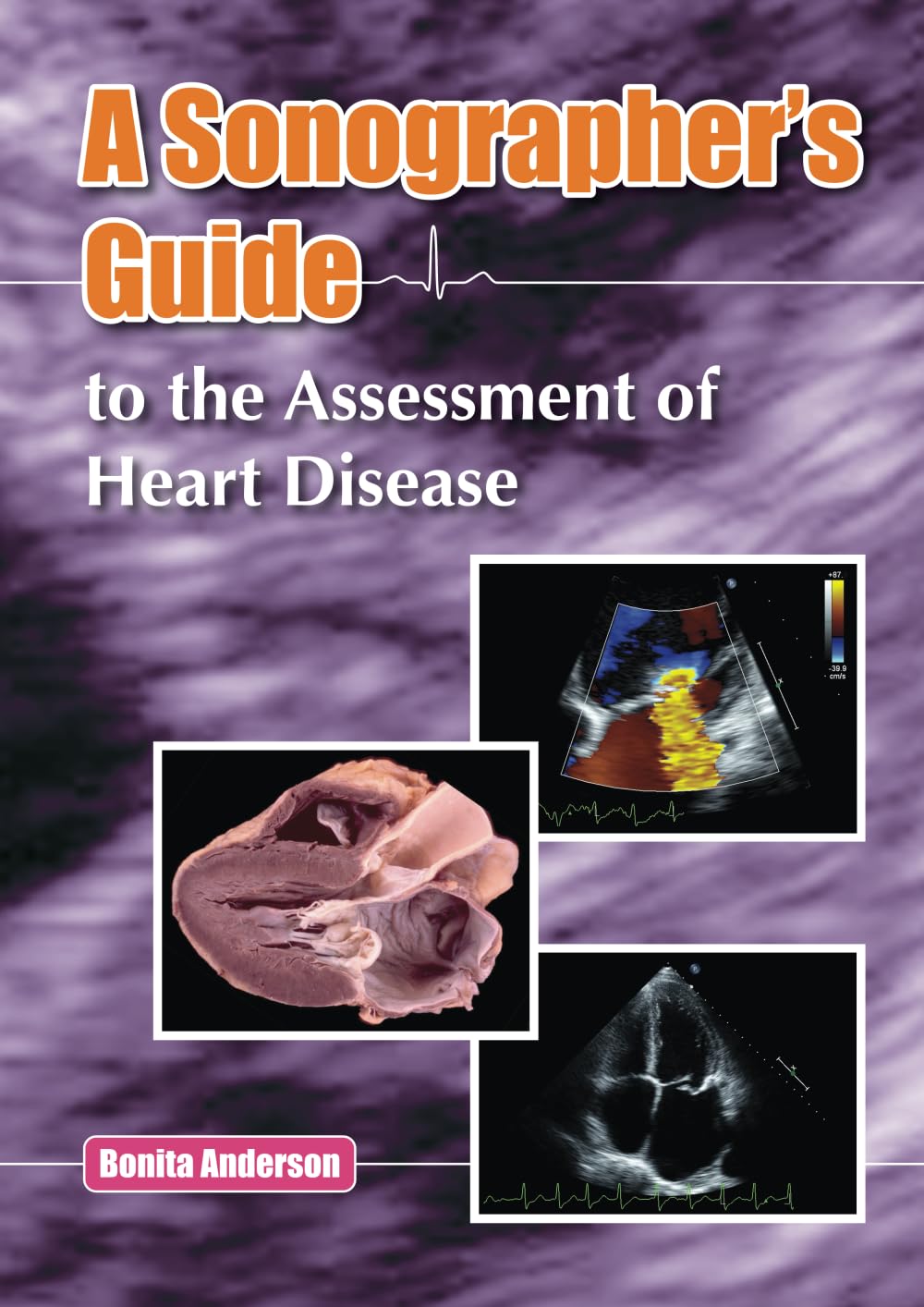 Cover of A Sonographer’s Guide to the Assessment of Heart Disease
