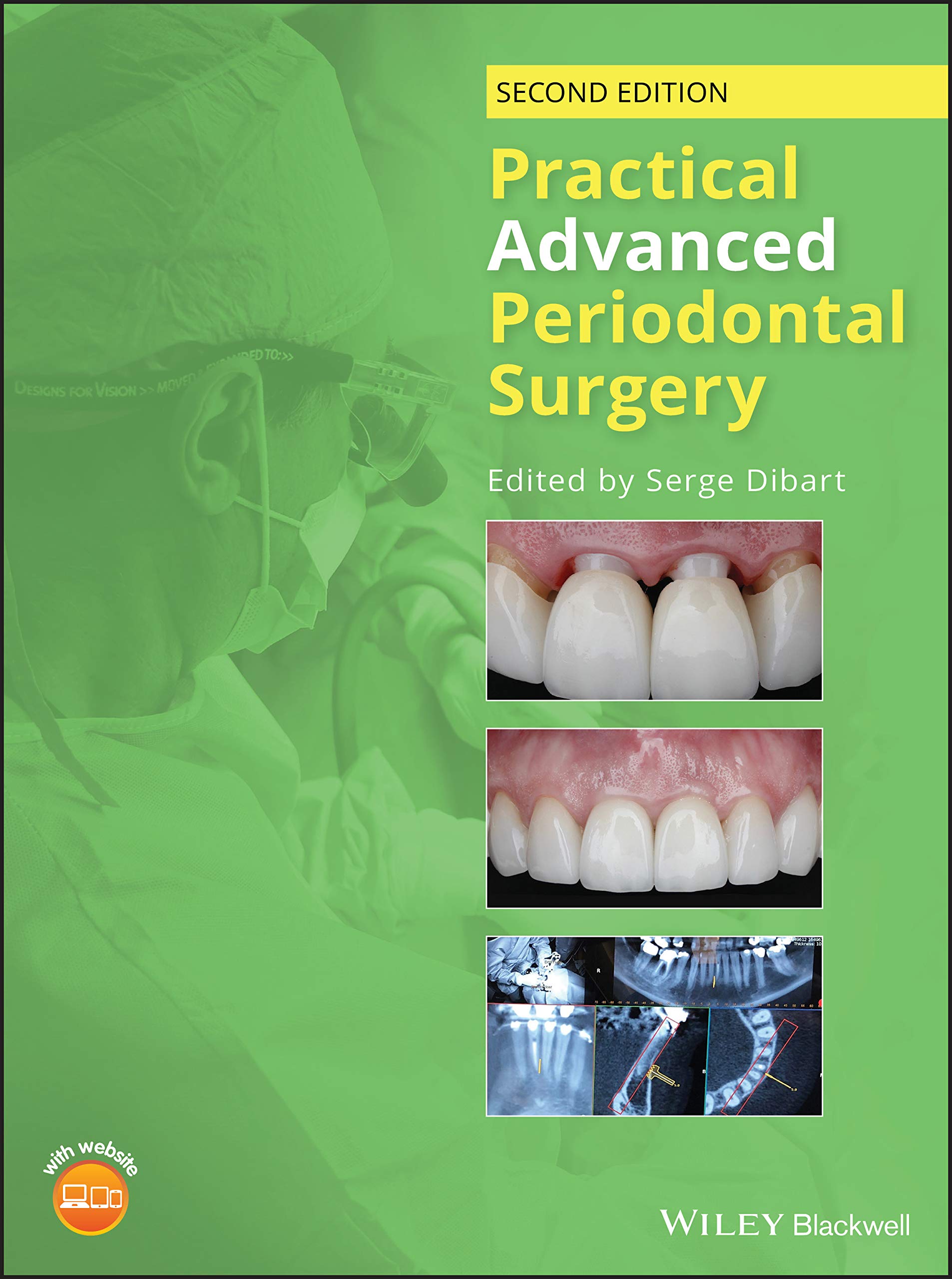 Cover of Practical Advanced Periodontal Surgery