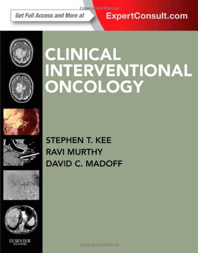 Cover of Clinical Interventional Oncology: Expert Consult - Online and Print, 1e