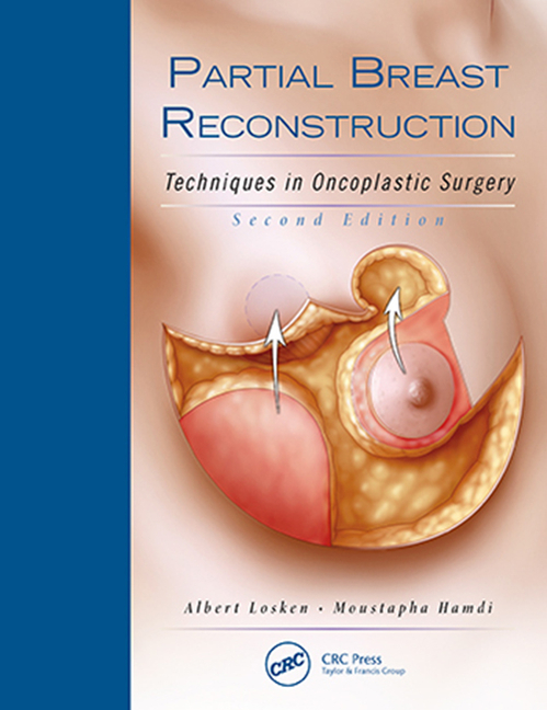 Cover of Partial Breast Reconstruction: Techniques in Oncoplastic Surgery