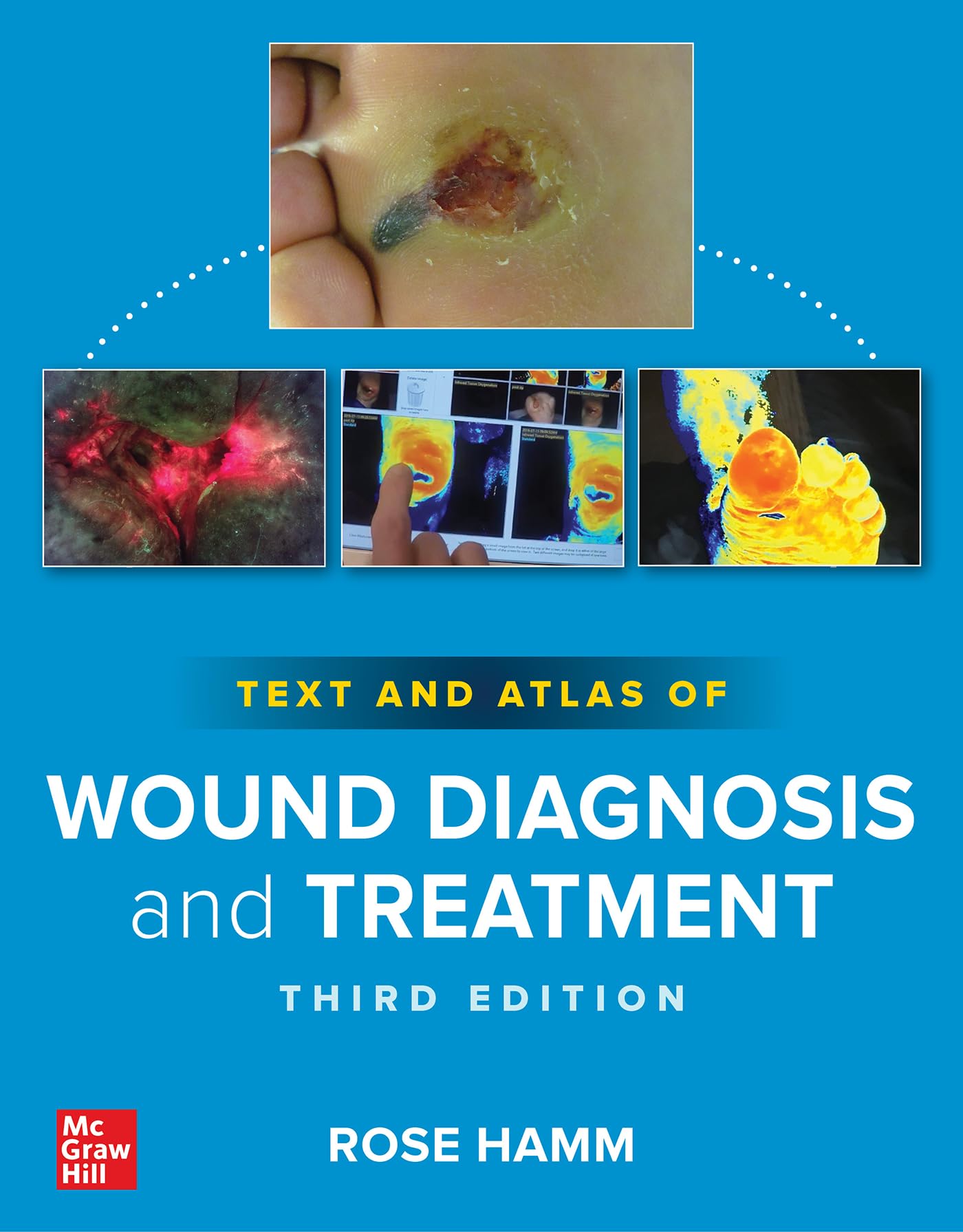 Cover of Text and Atlas of Wound Diagnosis and Treatment, Third Edition