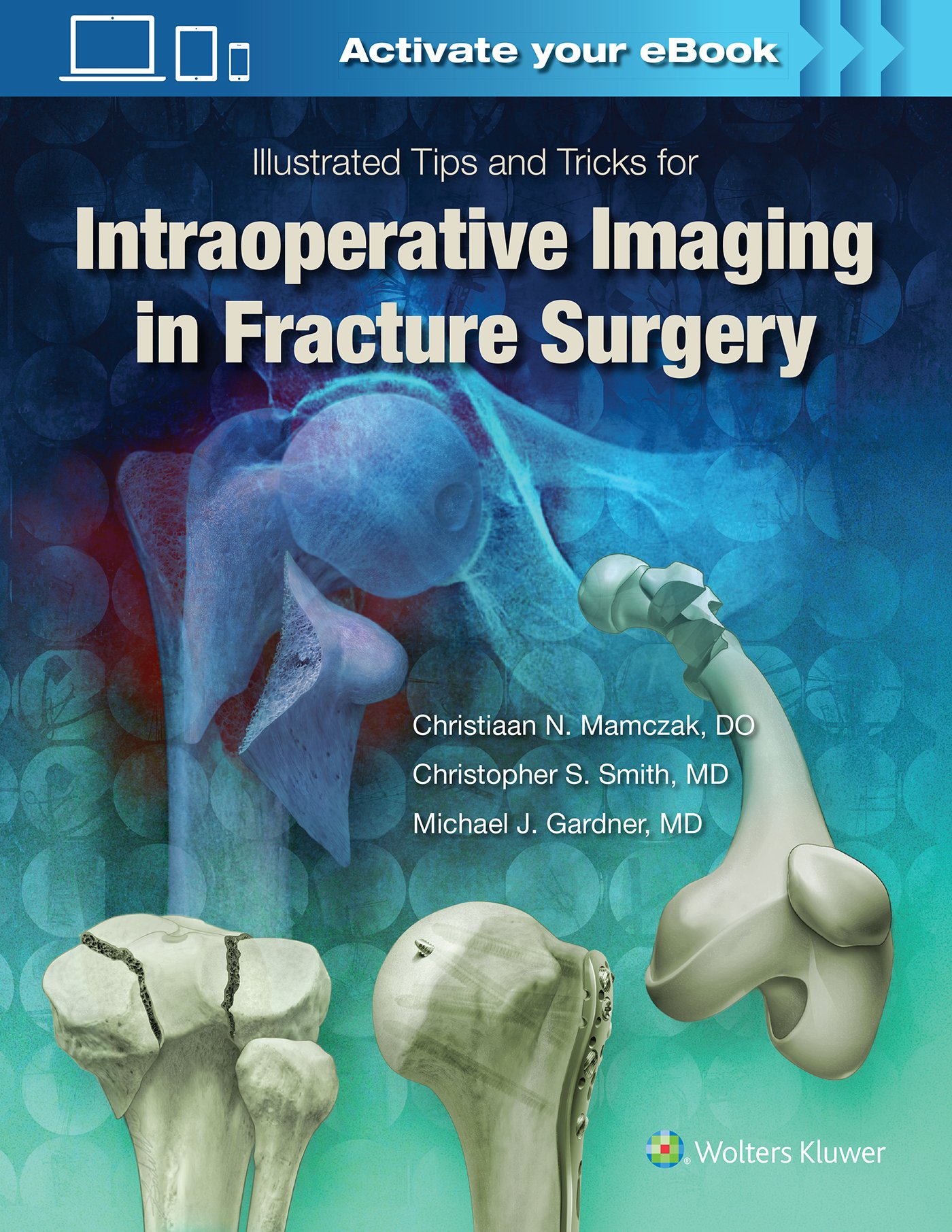 Cover of Illustrated Tips and Tricks for Intraoperative Imaging in Fracture Surgery