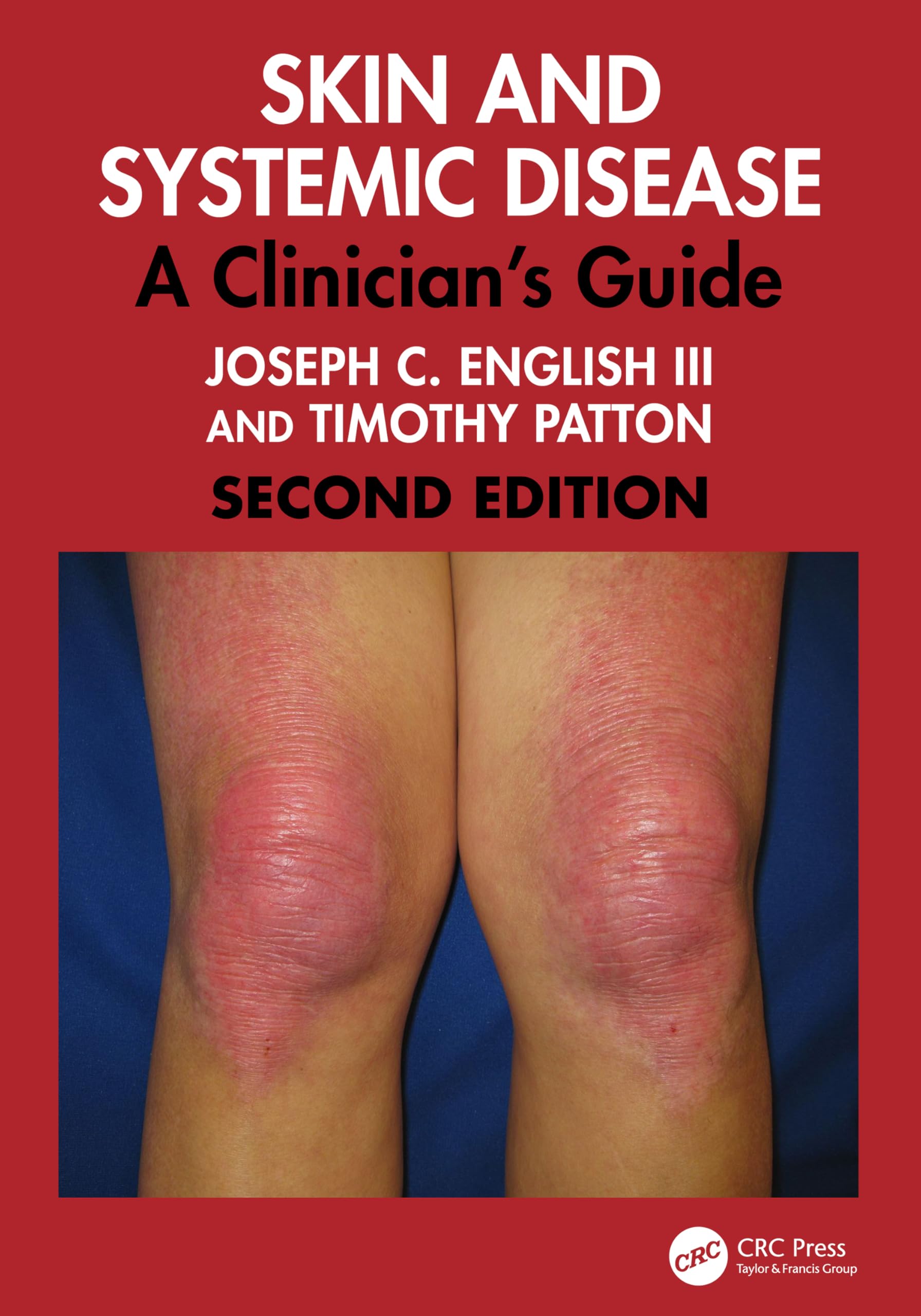 Cover of Skin and Systemic Disease: A Clinician's Guide