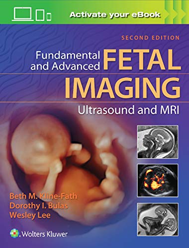 Cover of Fundamental and Advanced Fetal Imaging Ultrasound and MRI
