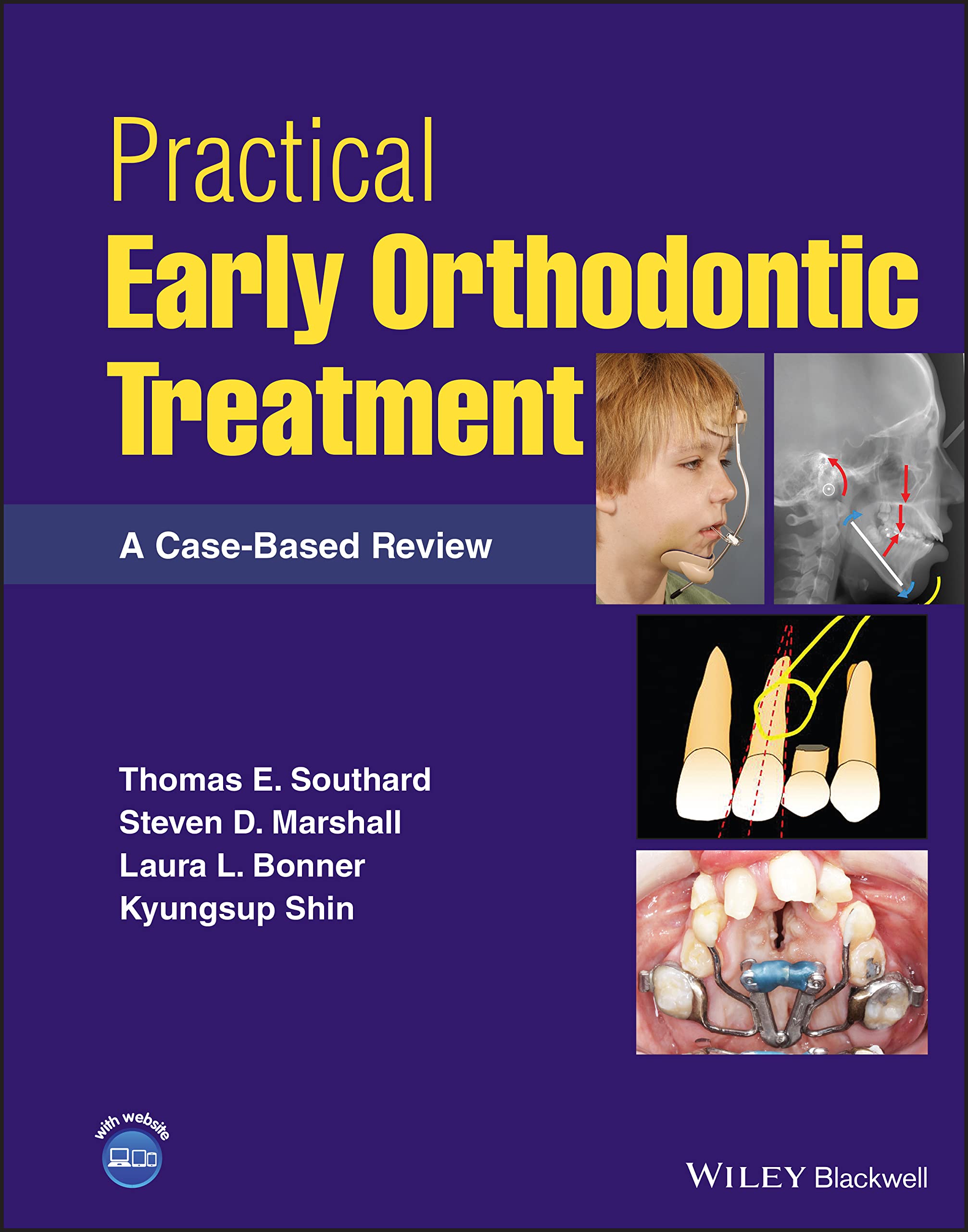 Cover of Practical Early Orthodontic Treatment: A Case-Based Review