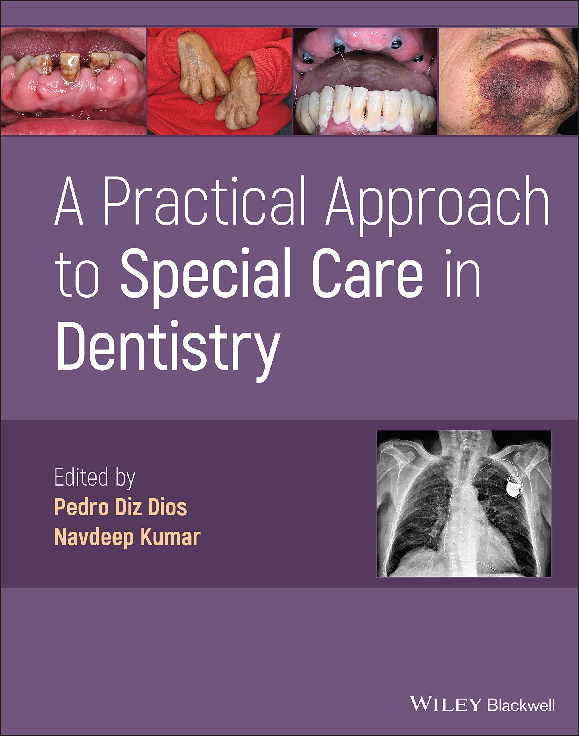 Cover of A Practical Approach to Special Care in Dentistry