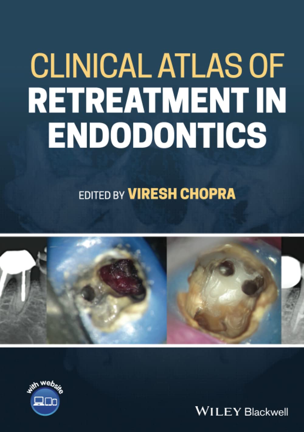 Cover of Clinical Atlas of Retreatment in Endodontics