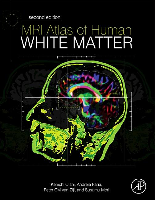 Cover of MRI Atlas of Human White Matter