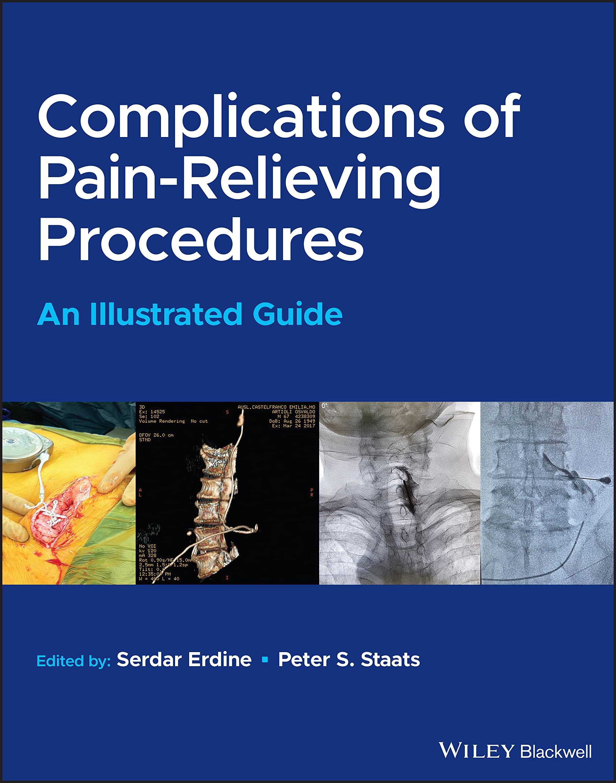 Cover of Complications of Pain-Relieving Procedures: An Illustrated Guide