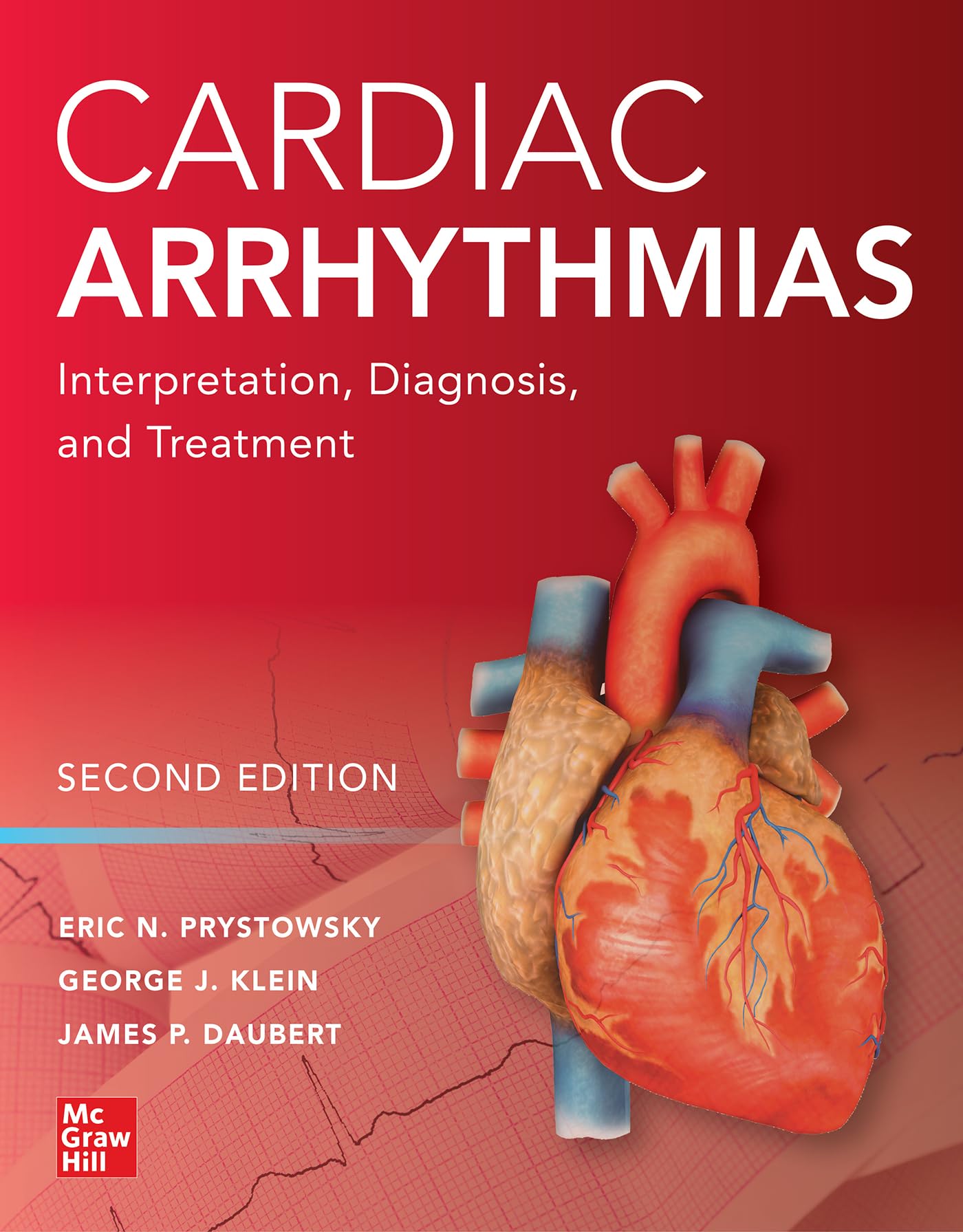 Cover of Cardiac Arrhythmias: Interpretation, Diagnosis and Treatment, Second Edition