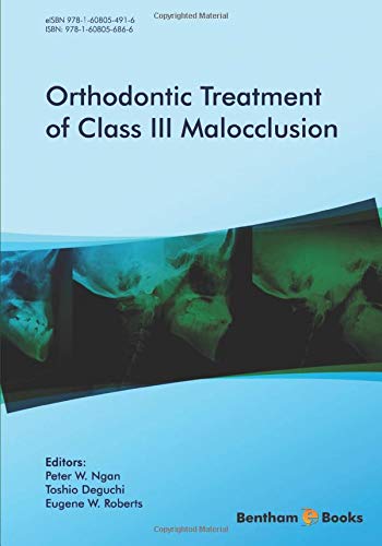 Cover of Orthodontic Treatment of Class III Malocclusion