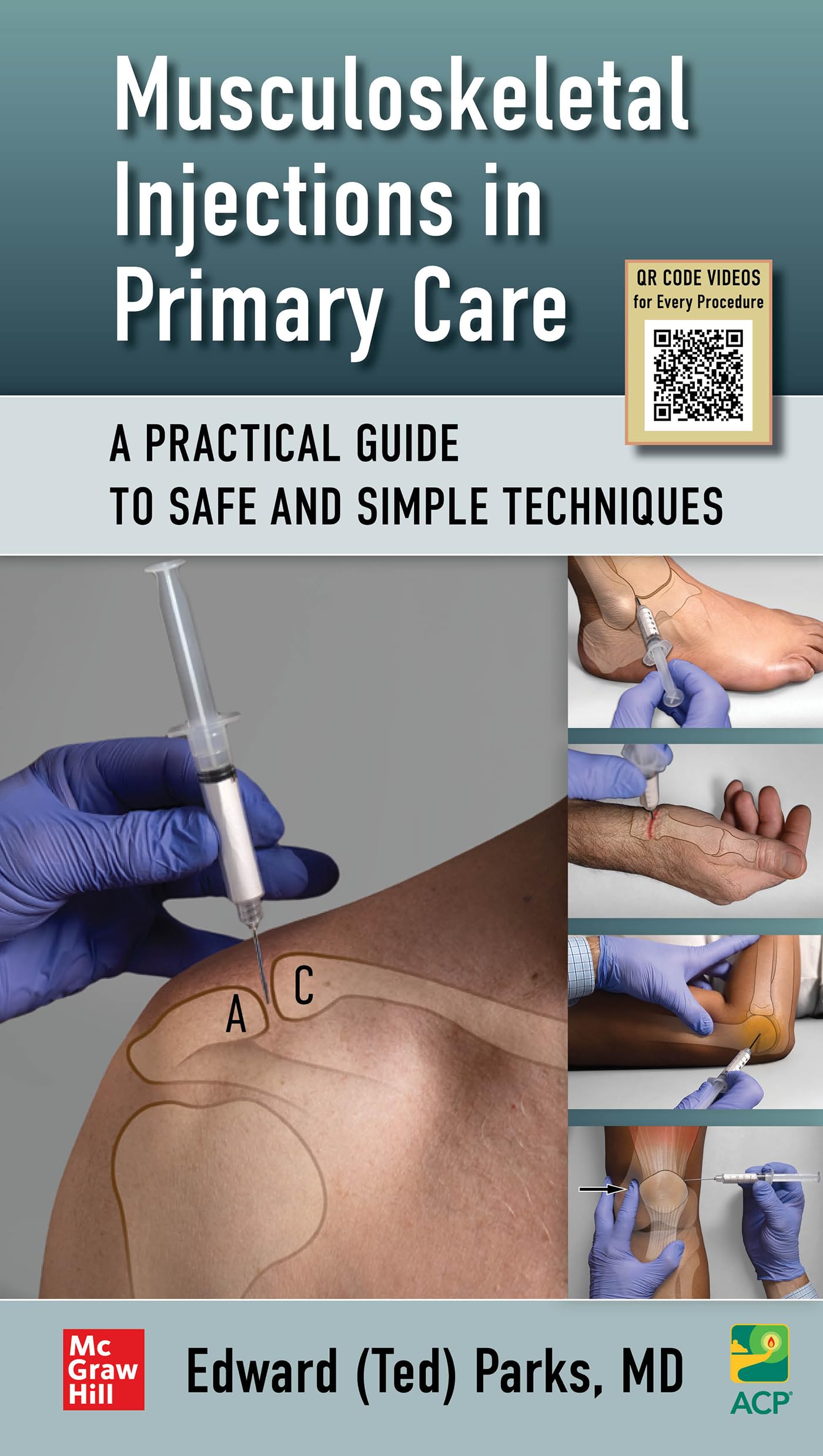 Cover of Musculoskeletal Injections in Primary Care: A Practical Guide to Safe and Simple Techniques