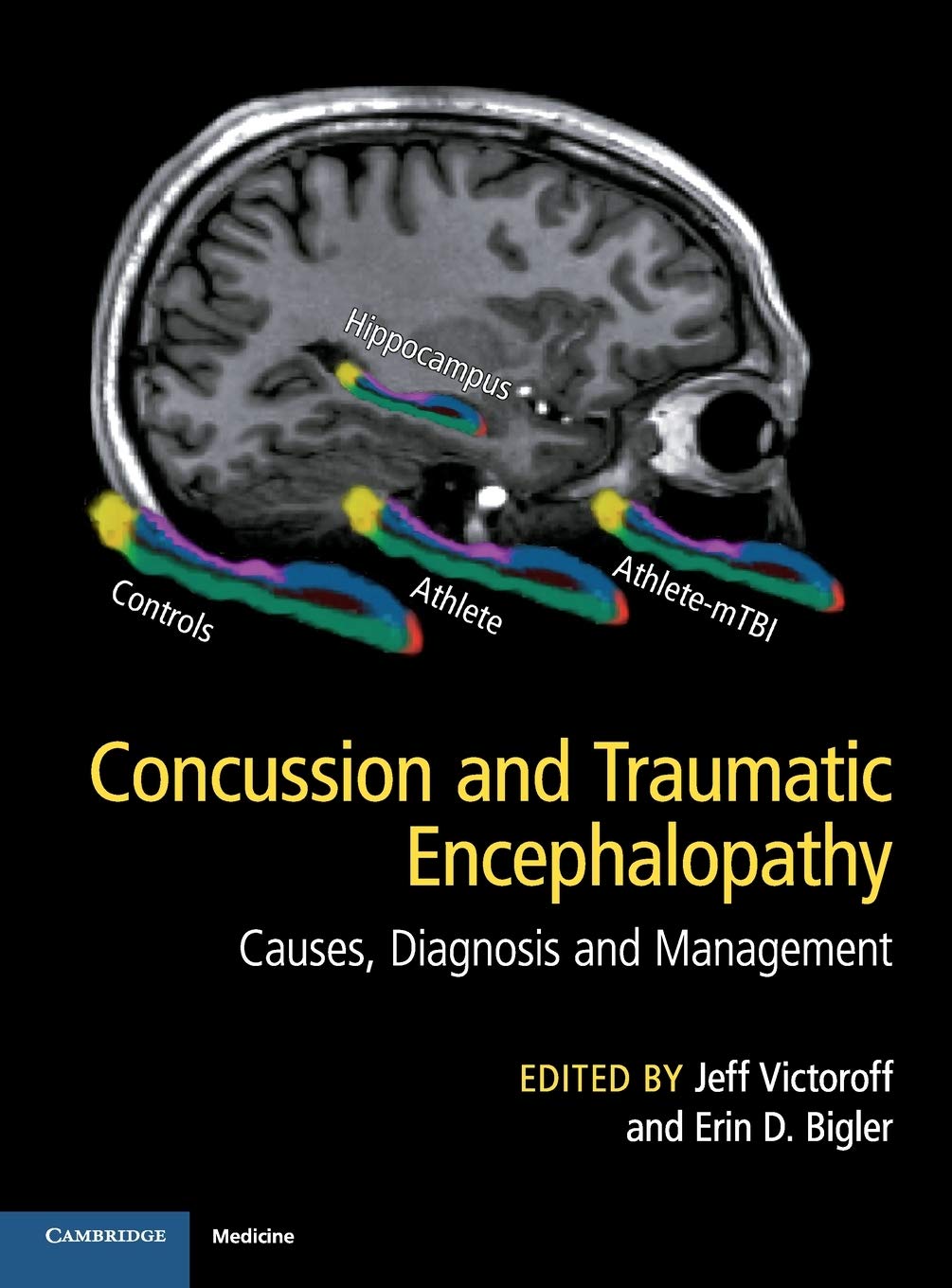Cover of Concussion and Traumatic Encephalopathy: Causes, Diagnosis and Management