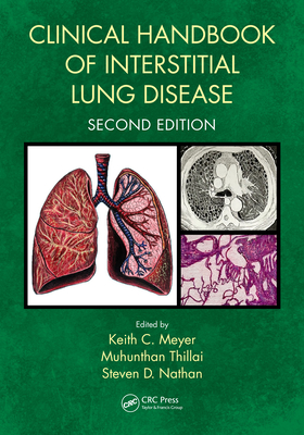 Cover of Clinical Handbook of Interstitial Lung Disease