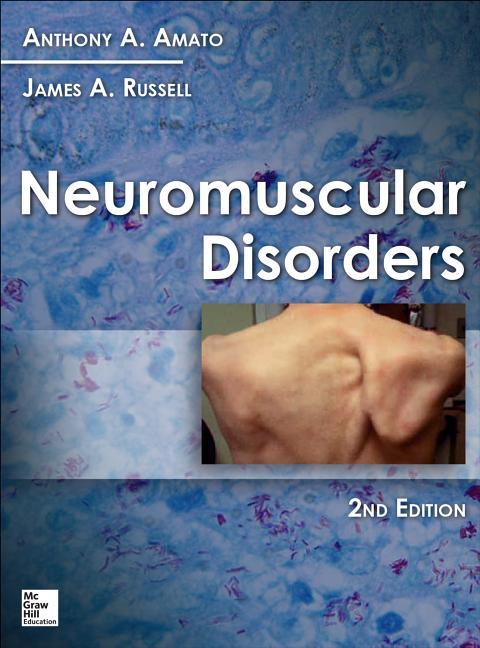 Cover of Neuromuscular Disorders, 2nd Edition (Revised)