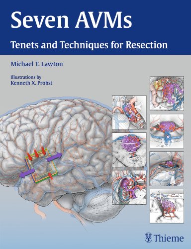 Cover of Seven Avms: Tenets and Techniques for Resection