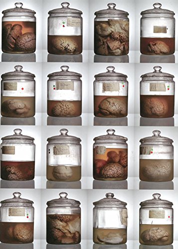Cover of Malformed: Forgotten Brains of the Texas State Mental Hospital