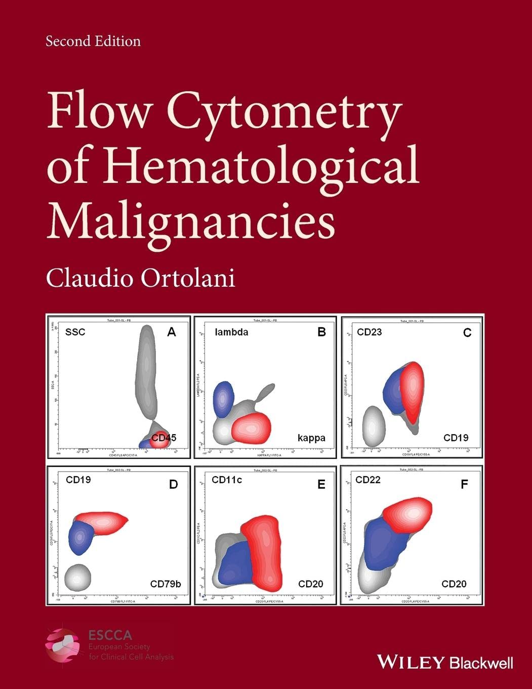 Cover of Flow Cytometry of Hematological Malignancies