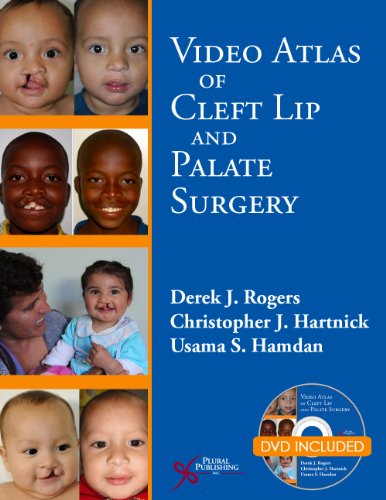 Cover of Video Atlas of Cleft Lip and Palate Surgery