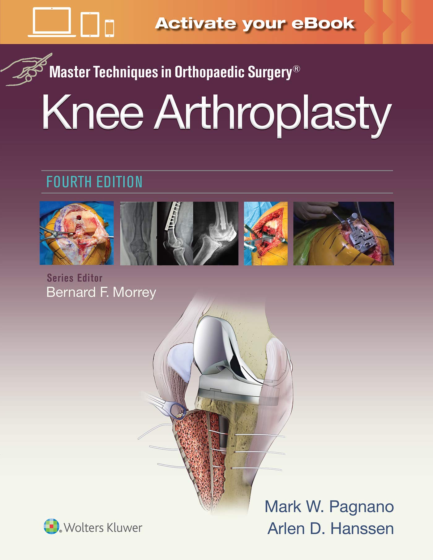 Cover of Master Techniques in Orthopedic Surgery: Knee Arthroplasty