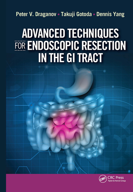 Cover of Advanced Techniques for Endoscopic Resection in the GI Tract