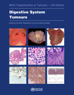Cover of Digestive System Tumours: Who Classification of Tumours