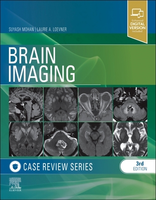 Cover of Brain Imaging: Case Review Series