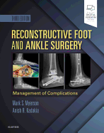 Cover of Reconstructive Foot and Ankle Surgery: Management of Complications