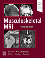 Cover of Musculoskeletal MRI