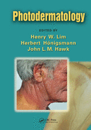 Cover of Photodermatology
