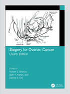 Cover of Surgery for Ovarian Cancer