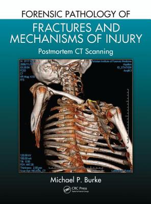 Cover of Forensic Pathology of Fractures and Mechanisms of Injury: Postmortem CT Scanning