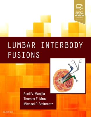 Cover of Lumbar Interbody Fusions