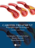 Cover of Carotid Treatment: Principles and Techniques