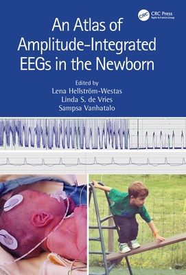 Cover of An Atlas of Amplitude-Integrated Eegs in the Newborn