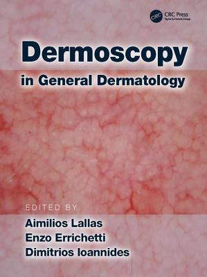 Cover of Dermoscopy in General Dermatology