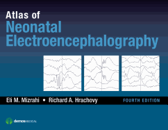 Cover of Atlas of Neonatal Electroencephalography